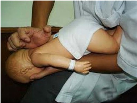 xu tri be bi sac chao